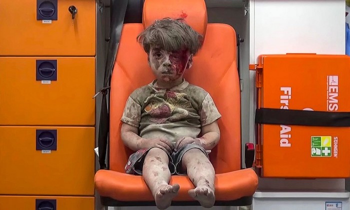 Omran Daqneesh (5 ani), victimă a bombardamentelor din Alep, Siria. Imaginea a făcut înconjurul lumii